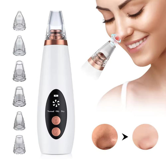 6-in-1 Electric Blackhead Remover with Vacuum Suction