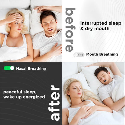 30 Pcs Anti Snore Mouth Tape – Gentle Nasal Breathing Sleep Strips