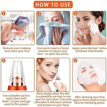 6-in-1 Electric Blackhead Remover with Vacuum Suction